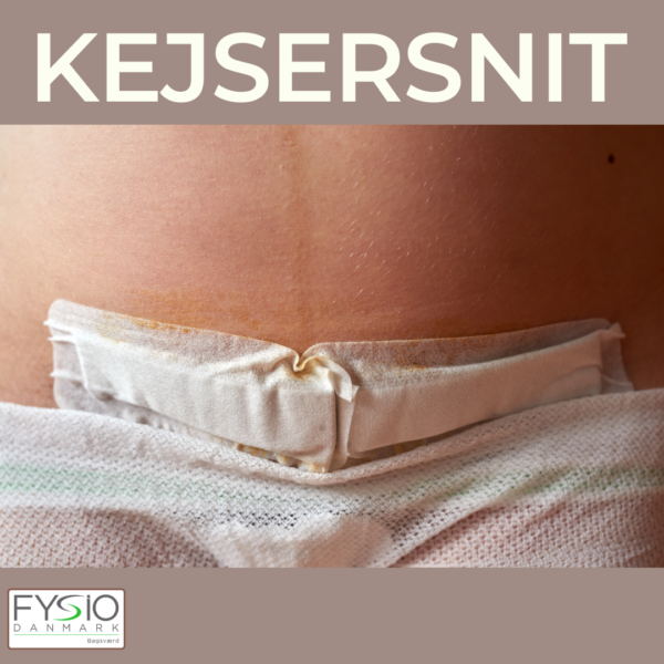 Kejsersnit 02